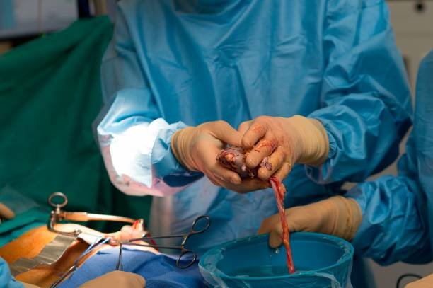 تجارة الأعضاء في مصر.. قانون صارم وسوق سوداء لا ترحم المرضى