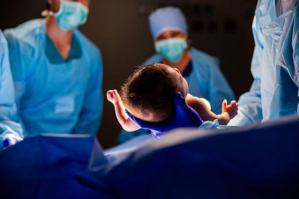 ارتفاع الولادات القيصرية في مصر